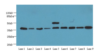 GAPDH Antibody - Western blot using GADPH antibody at 2 ug/ml.  Lane 1, HeLa cell lysate; Lane 2, A549 cell lysate; Lane 3, HepG2 cell lysates; Lane 4, K562 cell lysate; Lane 5, Jurkat cell lysate; Lane 6, MDA-MB-231 cell lysate; Lane 7, LO2 cell lysate; Lane 8, U251 cell lysate; and Lane 9, MCF-7 cell lysate.