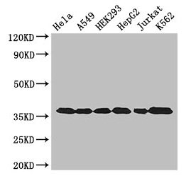 GAPDH Antibody - Western Blot Positive WB detected in: Hela whole cell lysate, A549 whole cell lysate, HEK293 whole cell lysate, HepG2 whole cell lysate, Jurkat whole cell lysate, K562 whole cell lysate All lanes: GAPDH antibody at 3µg/ml Secondary Goat polyclonal to rabbit IgG at 1/50000 dilution Predicted band size: 37, 32 kDa Observed band size: 37 kDa