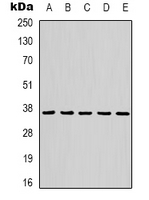 GAPDH Antibody - Western blot analysis of GAPDH expression in HeLa (A); mouse brain (B); rat brain (C); rabbit muscle (D); sheep muscle (E) whole cell lysates.