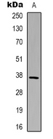 GAPDH Antibody - Western blot analysis of GAPDH expression in HeLa (A) whole cell lysates.