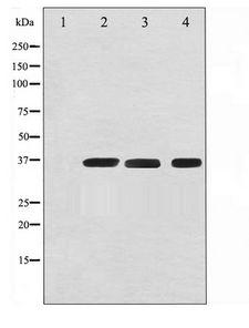 GAPDH Antibody - Western blot of HeLa (1), Jurkat (2), and COS-7(3) with GAPDH antibody(1;50000),The lane on the left is