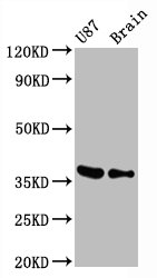 GAPDH Antibody - Western Blot Positive WB detected in:U87 whole cell lysate, Mouse brain tissue All Lanes:GAPDH antibody at 0.31µg/ml Secondary Goat polyclonal to rabbit IgG at 1/50000 dilution Predicted band size: 36 KDa Observed band size: 36 KDa