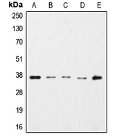 GAPDH Antibody - Western blot analysis of GAPDH expression in HepG2 (A); K562 (B); NIH3T3 (C); Raw264.7 (D); PC12 (E) whole cell lysates.
