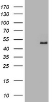 GAPDHS / GAPDS Antibody - HEK293T cells were transfected with the pCMV6-ENTRY control (Left lane) or pCMV6-ENTRY GAPDHS (Right lane) cDNA for 48 hrs and lysed. Equivalent amounts of cell lysates (5 ug per lane) were separated by SDS-PAGE and immunoblotted with anti-GAPDHS.