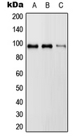 GAPIII / RASA3 Antibody - Western blot analysis of RASA3 expression in HeLa (A); SP2/0 (B); H9C2 (C) whole cell lysates.