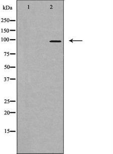 GAPIII / RASA3 Antibody - Western blot analysis of extracts of HeLa cells using RASA3 antibody. The lane on the left is treated with the antigen-specific peptide.