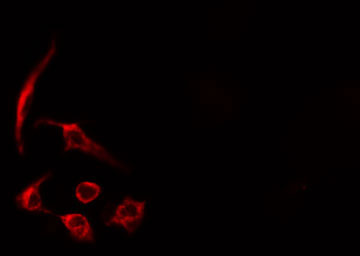 GAPIII / RASA3 Antibody - Staining HeLa cells by IF/ICC. The samples were fixed with PFA and permeabilized in 0.1% Triton X-100, then blocked in 10% serum for 45 min at 25°C. The primary antibody was diluted at 1:200 and incubated with the sample for 1 hour at 37°C. An Alexa Fluor 594 conjugated goat anti-rabbit IgG (H+L) antibody, diluted at 1/600, was used as secondary antibody.