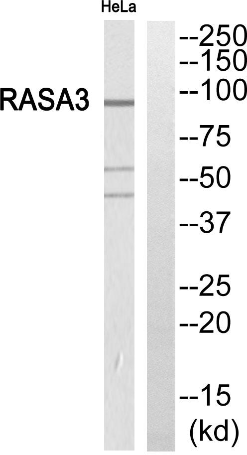 GAPIII / RASA3 Antibody - Western blot analysis of extracts from HeLa cells, using RASA3 antibody.