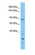 GAPIII / RASA3 Antibody - Western blot of RASA3 Antibody with human HeLa Whole Cell lysate.  This image was taken for the unconjugated form of this product. Other forms have not been tested.