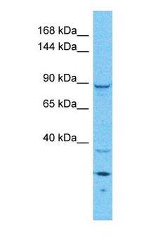 GAPIII / RASA3 Antibody - Western blot of RASA3 Antibody with human HeLa Whole Cell lysate.  This image was taken for the unconjugated form of this product. Other forms have not been tested.