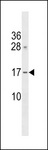 GAPT Antibody - GAPT Antibody western blot of NCI-H460 cell line lysates (35 ug/lane). The GAPT antibody detected the GAPT protein (arrow).