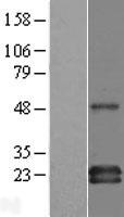 GAPT Protein - Western validation with an anti-DDK antibody * L: Control HEK293 lysate R: Over-expression lysate