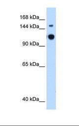 GAPVD1 Antibody - HepG2 cell lysate. Antibody concentration: 0.25 ug/ml. Gel concentration: 8%.  This image was taken for the unconjugated form of this product. Other forms have not been tested.