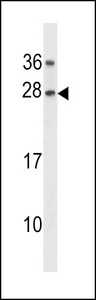 GAR1 / NOLA1 Antibody - GAR1 Antibody western blot of K562 cell line lysates (35 ug/lane). The GAR1 antibody detected the GAR1 protein (arrow).