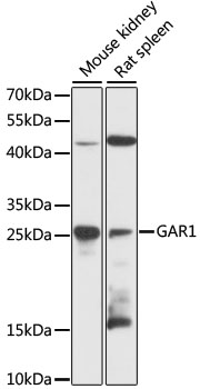 GAR1 / NOLA1 Antibody - Western blot analysis of extracts of various cell lines, using GAR1 antibody at 1:3000 dilution. The secondary antibody used was an HRP Goat Anti-Rabbit IgG (H+L) at 1:10000 dilution. Lysates were loaded 25ug per lane and 3% nonfat dry milk in TBST was used for blocking. An ECL Kit was used for detection and the exposure time was 90s.