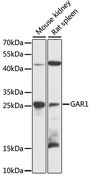 GAR1 / NOLA1 Antibody - Western blot analysis of extracts of various cell lines, using GAR1 antibody at 1:3000 dilution. The secondary antibody used was an HRP Goat Anti-Rabbit IgG (H+L) at 1:10000 dilution. Lysates were loaded 25ug per lane and 3% nonfat dry milk in TBST was used for blocking. An ECL Kit was used for detection and the exposure time was 90s.