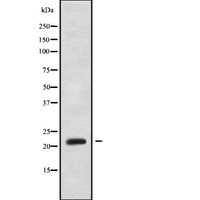 GAR1 / NOLA1 Antibody - Western blot analysis NOLA1 using HuvEc whole cells lysates