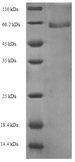 Gardnerella vaginalis Modification Methylase AccI Protein - (Tris-Glycine gel) Discontinuous SDS-PAGE (reduced) with 5% enrichment gel and 15% separation gel.