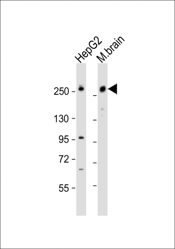 GARNL1 / RALGAPA1 Antibody - All lanes: Anti-RALGAPA1 Antibody (N-Term) at 1:1000-1:2000 dilution. Lane 1: HepG2 whole cell lysate. Lane 2: mouse brain lysate Lysates/proteins at 20 ug per lane. Secondary Goat Anti-Rabbit IgG, (H+L), Peroxidase conjugated at 1:10000 dilution. Predicted band size: 230 kDa. Blocking/Dilution buffer: 5% NFDM/TBST.