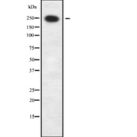 GARNL1 / RALGAPA1 Antibody - Western blot analysis of RALGAPA1 using HuvEc whole cells lysates