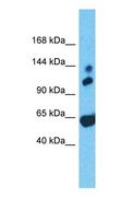 GARNL1 / RALGAPA1 Antibody - Western blot of RALGAPA1 Antibody with human Fetal Heart lysate.  This image was taken for the unconjugated form of this product. Other forms have not been tested.
