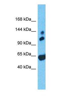 GARNL1 / RALGAPA1 Antibody - Western blot of RALGAPA1 Antibody with human Fetal Heart lysate.  This image was taken for the unconjugated form of this product. Other forms have not been tested.