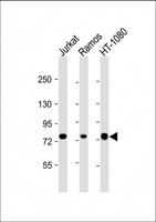 GARS / Glycyl tRNA Synthetase Antibody - All lanes: Anti-GARS Antibody at 1:4000 dilution. Lane 1: Jurkat whole cell lysate. Lane 2: Ramos whole cell lysate. Lane 3: HT-1080 whole cell lysate Lysates/proteins at 20 ug per lane. Secondary Goat Anti-mouse IgG, (H+L), Peroxidase conjugated at 1:10000 dilution. Predicted band size: 83 kDa. Blocking/Dilution buffer: 5% NFDM/TBST.