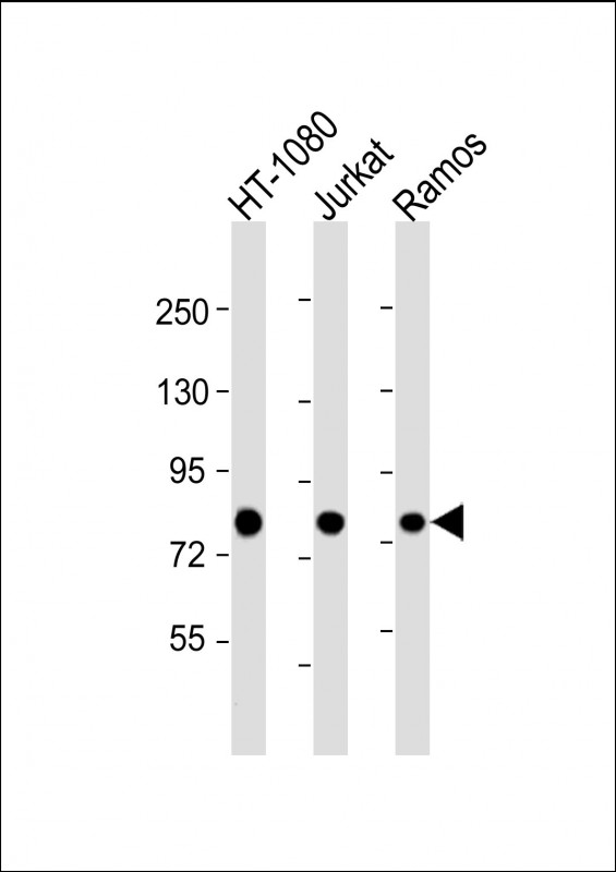 GARS / Glycyl tRNA Synthetase Antibody - All lanes: Anti-GARS Antibody at 1:4000 dilution. Lane 1: HT-1080 whole cell lysate. Lane 2: Jurkat whole cell lysate. Lane 3: Ramos whole cell lysate Lysates/proteins at 20 ug per lane. Secondary Goat Anti-mouse IgG, (H+L), Peroxidase conjugated at 1:10000 dilution. Predicted band size: 83 kDa. Blocking/Dilution buffer: 5% NFDM/TBST.