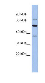 GARS / Glycyl tRNA Synthetase Antibody - GARS antibody Western blot of MCF7 cell lysate. This image was taken for the unconjugated form of this product. Other forms have not been tested.