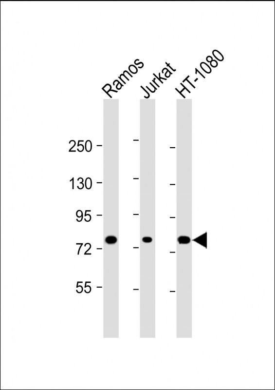 GARS / Glycyl tRNA Synthetase Antibody - All lanes: Anti-GARS Antibody at 1:4000 dilution Lane 1: Ramos whole cell lysate Lane 2: Jurkat whole cell lysate Lane 3: HT-1080 whole cell lysate Lysates/proteins at 20 µg per lane. Secondary Goat Anti-mouse IgG, (H+L), Peroxidase conjugated at 1/10000 dilution. Predicted band size: 83 kDa Blocking/Dilution buffer: 5% NFDM/TBST.