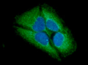 GARS / Glycyl tRNA Synthetase Antibody - ICC/IF analysis of GARS in HeLa cells line, stained with DAPI (Blue) for nucleus staining and monoclonal anti-human GARS antibody (1:100) with goat anti-mouse IgG-Alexa fluor 488 conjugate (Green).