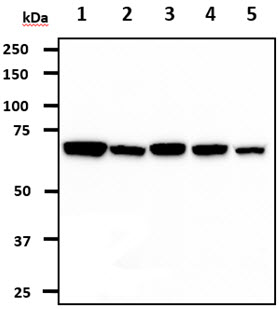 GARS / Glycyl tRNA Synthetase Antibody - The cell lysates (40ug) were resolved by SDS-PAGE, transferred to PVDF membrane and probed with anti-human GARS (1:1000). Proteins were visualized using a goat anti-mouse secondary antibody conjugated to HRP and an ECL detection system. Lane 1.: HeLa cell lysate Lane 2.: 293T cell lysate Lane 3.: Jurkat cell lysate Lane 4.: U87-MG cell lysate Lane 5.: A431 cell lysate