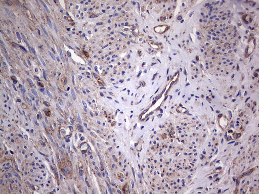 GARS / Glycyl tRNA Synthetase Antibody - Immunohistochemical staining of paraffin-embedded Human endometrium tissue within the normal limits using anti-GARS mouse monoclonal antibody. (Heat-induced epitope retrieval by 1 mM EDTA in 10mM Tris, pH8.5, 120C for 3min,
