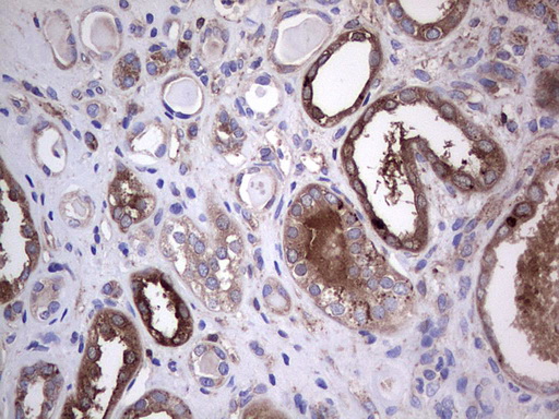 GARS / Glycyl tRNA Synthetase Antibody - Immunohistochemical staining of paraffin-embedded Human Kidney tissue within the normal limits using anti-GARS mouse monoclonal antibody. (Heat-induced epitope retrieval by 1 mM EDTA in 10mM Tris, pH8.5, 120C for 3min,