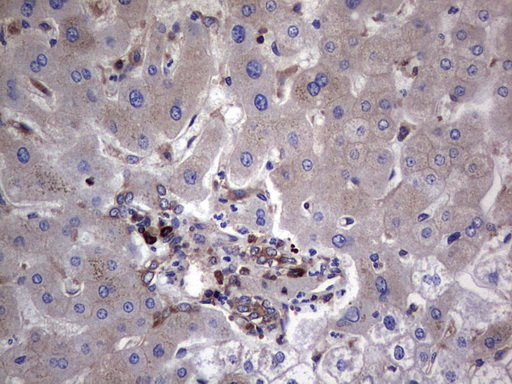 GARS / Glycyl tRNA Synthetase Antibody - Immunohistochemical staining of paraffin-embedded Human liver tissue within the normal limits using anti-GARS mouse monoclonal antibody. (Heat-induced epitope retrieval by 1 mM EDTA in 10mM Tris, pH8.5, 120C for 3min,
