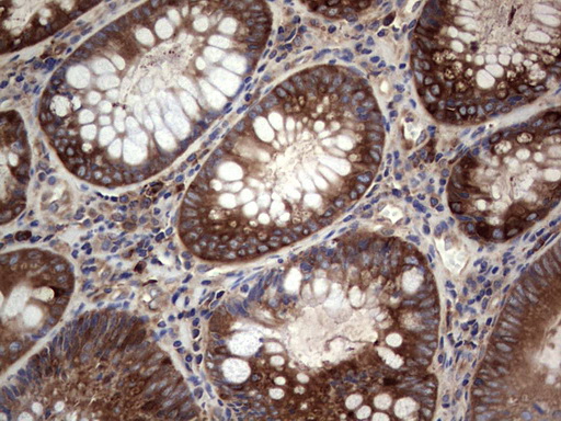 GARS / Glycyl tRNA Synthetase Antibody - IHC of paraffin-embedded Human colon tissue using anti-GARS mouse monoclonal antibody. (Heat-induced epitope retrieval by 1 mM EDTA in 10mM Tris, pH8.5, 120°C for 3min).