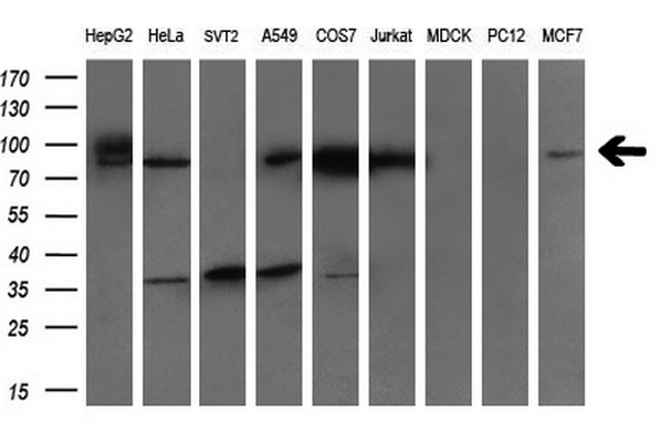 GARS / Glycyl tRNA Synthetase Antibody - Western blot analysis of extracts. (35ug) from 9 different cell lines by using anti-GARS monoclonal antibody. (HepG2: human; HeLa: human; SVT2: mouse; A549: human; COS7: monkey; Jurkat: human; MDCK: canine;rat; MCF7: human). (1:200)