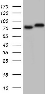GARS / Glycyl tRNA Synthetase Antibody - HEK293T cells were transfected with the pCMV6-ENTRY control (Left lane) or pCMV6-ENTRY GARS (Right lane) cDNA for 48 hrs and lysed. Equivalent amounts of cell lysates (5 ug per lane) were separated by SDS-PAGE and immunoblotted with anti-GARS.