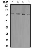GARS / Glycyl tRNA Synthetase Antibody - Western blot analysis of GlyRS expression in Jurkat (A); Raji (B); HT29 (C); mouse brain (D) whole cell lysates.