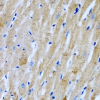 GARS / Glycyl tRNA Synthetase Antibody - Immunohistochemical analysis of GlyRS staining in rat heart formalin fixed paraffin embedded tissue section. The section was pre-treated using heat mediated antigen retrieval with sodium citrate buffer (pH 6.0). The section was then incubated with the antibody at room temperature and detected using an HRP conjugated compact polymer system. DAB was used as the chromogen. The section was then counterstained with hematoxylin and mounted with DPX.