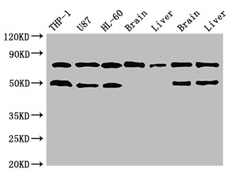 GARS / Glycyl tRNA Synthetase Antibody - Positive WB detected in:THP-1 whole cell lysate,U87 whole cell lysate,HL-60 whole cell lysate,Mouse brain tissue,Mouse liver tissue,Rat brain tissue,Rat liver tissue;All lanes:GARS antibody at 3?g/ml;Secondary;Goat polyclonal to rabbit IgG at 1/50000 dilution;Predicted band size: 84 KDa;Observed band size: 84,50 KDa;