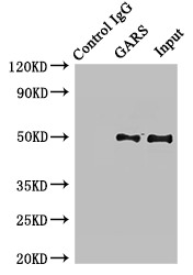 GARS / Glycyl tRNA Synthetase Antibody - Immunoprecipitating GARS in HL-60 whole cell lysate;Lane 1: Rabbit monoclonal IgG(1?g)instead of GARS Antibody in HL-60 whole cell lysate.For western blotting,a HRP-conjugated Protein G antibody was used as the secondary antibody (1/2000);Lane 2: GARS Antibody(8?g)+ HL-60 whole cell lysate(500?g);Lane 3: HL-60 whole cell lysate (20?g);