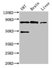 GARS / Glycyl tRNA Synthetase Antibody - Western Blot Positive WB detected in: U87 whole cell lysate, Mouse brain tissue, Mouse liver tissue All lanes: GARS antibody at 3µg/ml Secondary Goat polyclonal to rabbit IgG at 1/50000 dilution Predicted band size: 84 kDa Observed band size: 84 kDa