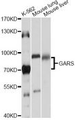 GARS / Glycyl tRNA Synthetase Antibody - Western blot analysis of extracts of various cell lines, using GARS antibody at 1:1000 dilution. The secondary antibody used was an HRP Goat Anti-Rabbit IgG (H+L) at 1:10000 dilution. Lysates were loaded 25ug per lane and 3% nonfat dry milk in TBST was used for blocking. An ECL Kit was used for detection and the exposure time was 5s.