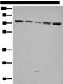 GARS / Glycyl tRNA Synthetase Antibody - Western blot analysis of Hela and A431 cell Mouse brain tissue HT-29 and Jurkat cell lysates  using GARS Polyclonal Antibody at dilution of 1:540