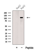 GART / GARS Antibody - Western blot analysis of extracts of HepG2 cells using GART antibody. The lane on the left was treated with blocking peptide.