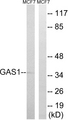 GAS1 Antibody - Western blot analysis of lysates from MCF-7 cells, using GAS1 Antibody. The lane on the right is blocked with the synthesized peptide.