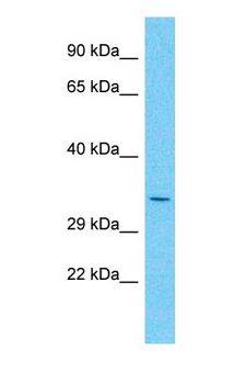 GAS1 Antibody - Western blot of GAS1 Antibody with human HeLa Whole Cell lysate.  This image was taken for the unconjugated form of this product. Other forms have not been tested.