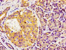 GAS1 Antibody - Immunohistochemistry image of paraffin-embedded human pancreatic tissue at a dilution of 1:100