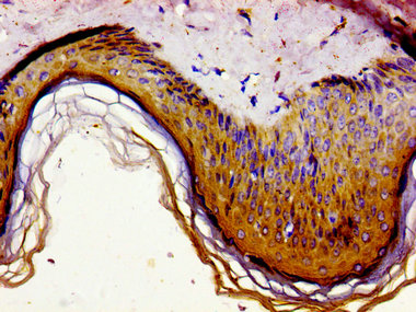 GAS1 Antibody - Immunohistochemistry image of paraffin-embedded human skin tissue at a dilution of 1:100